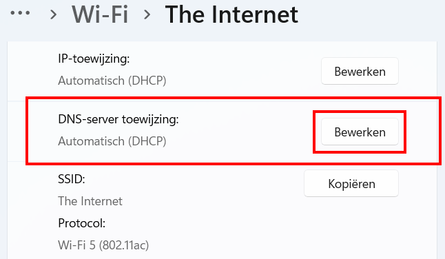 DNS-server toewijzing bewerken
